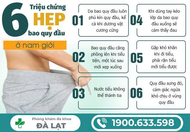 Hình ảnh minh họa